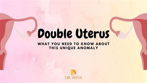 Woman with uterus didelphys reveals what it’s like to have two。